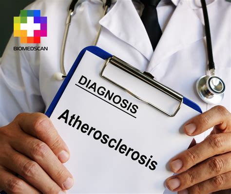 Ilustrație schematică a anatomiei vaginale și a zonelor afectate de pierderea elasticității