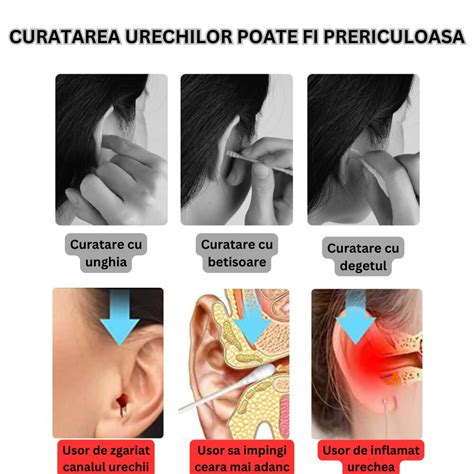 ilustrație medicală cu procedura de găurire a urechii unui bebeluș
