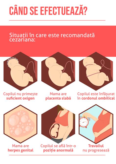 Ilustrație a uterului cu o cicatrice de cezariană și o placentă praevia.