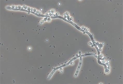 Ilustrație microscopică a ciupercii Candida Albicans