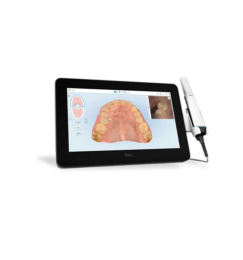 Ilustrație cu un scanner intraoral captând imaginea unui bont de scanare pe un implant