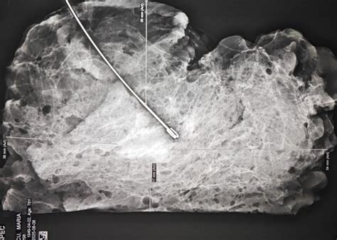 Diagramă pas cu pas a tehnicii de aplicare și îndepărtare a pastei de zahăr.