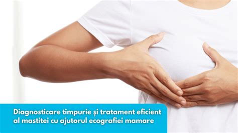 Ilustrație medicală care arată un canal mamar înfundat și semnele mastitei.