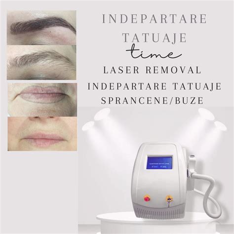 Schema de funcționare a laserului Nd:YAG în tratarea leziunilor vasculare