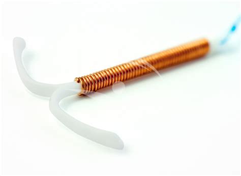 ilustrație a unui sterilet