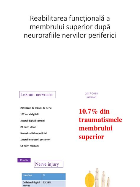 ilustrație schematică a nervilor periferici afectați