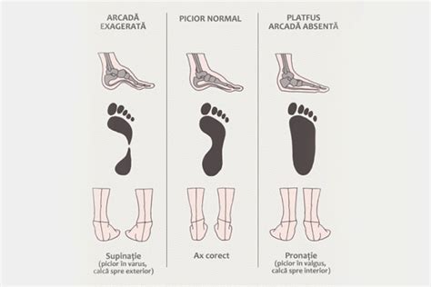 Diagramă comparativă între o articulație standard și una MEYLE-HD