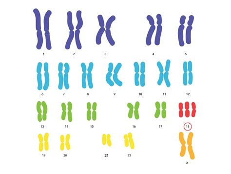 Ilustrație schematică a cromozomilor, evidențiind trisomia 21.