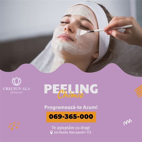 Infografic cu principalele modificări ale pielii în sarcină: hiperpigmentare, cloasmă, linia nigra, acnee, vergeturi