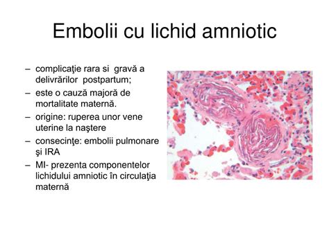 Infografic cu rolurile lichidului amniotic