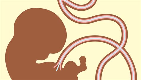 Imagine ecografică sau ilustrație a unui cordon ombilical înfășurat în jurul gâtului fătului.