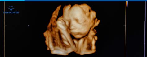 Diagramă care ilustrează fluxul decizional după rezultatele unui dublu test: risc scăzut, risc crescut și necesitatea testelor de diagnostic.