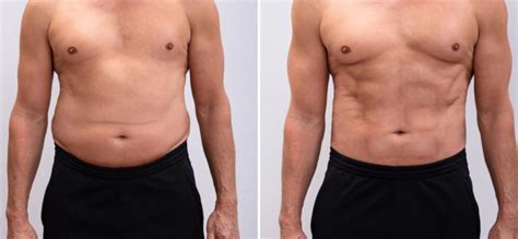 Imagine comparativă 