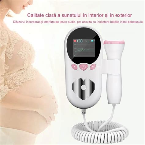 schemă ilustrând tipurile de decelerații ale ritmului cardiac fetal