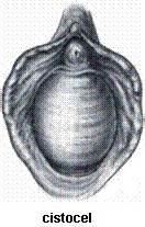 Ilustrație a speculului ginecologic și a modului de utilizare