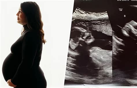 Fotografie cu un medic examinând o femeie însărcinată în perioada comunistă, subliniind condițiile precare.