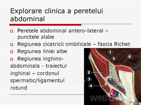 Ilustrație anatomică a peretelui abdominal cu o hernie externată