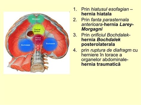 Diagramă comparativă a diferitelor tipuri de hernii abdominale