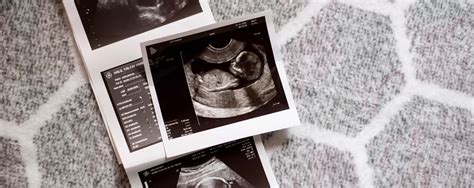 infografic explicativ despre ecografia morfologică fetală în trimestrul II