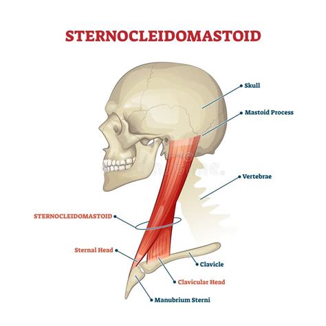 Schemă anatomică a mușchilor gâtului la bebeluși, evidențiind mușchiul sternocleidomastoidian