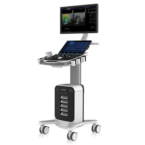 ecran ecograf cu imagini fetale detaliate