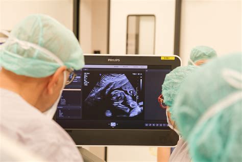 Fotografie a unei ecografii 3D a feței unui făt, evidențiind detaliile faciale.