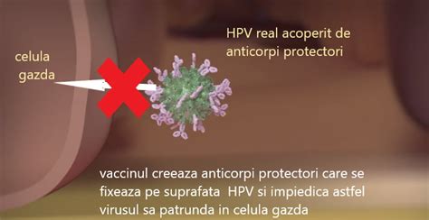 Infografic explicativ despre virusul HPV și stadiile de evoluție a displaziei cervicale