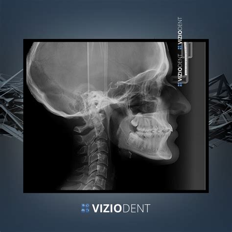 Imagine detaliată a unei papuși GABI MOON, evidențiind realismul feței și al corpului