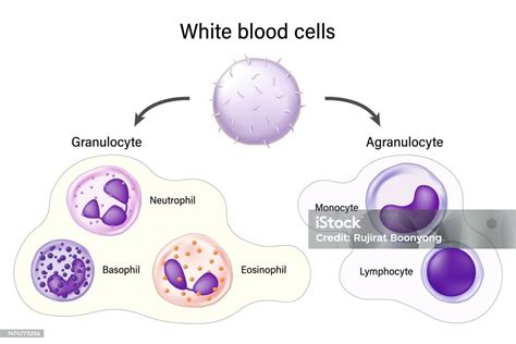 Imagine microscopică a leucocitelor (celule albe) în urină, indicând prezența unei infecții.