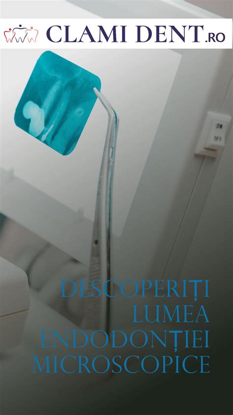 Infografic cu etapele tratamentului parodontal, de la diagnostic la monitorizare.