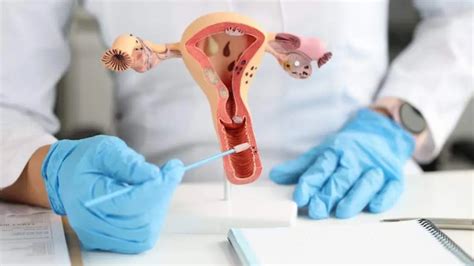 Ilustrație grafică a testului Babes Papanicolau și a colposcopiei, explicând vizual procesul.