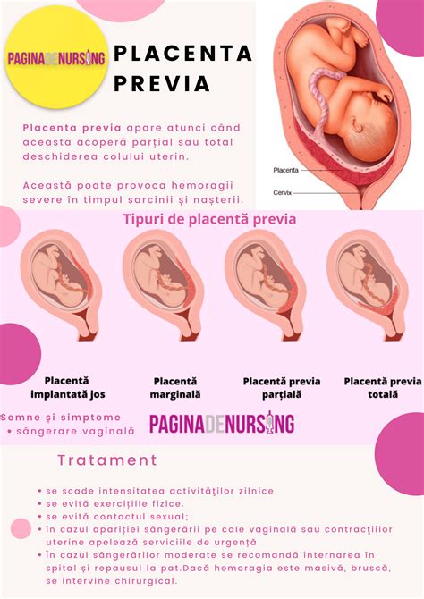 ilustrație cu placenta previa și placenta normală