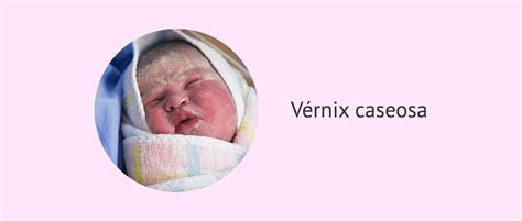 Imagine cu fătul în luna a cincea de sarcină, acoperit de vernix caseosa