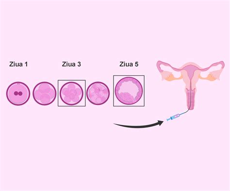 Tabel comparativ al calității embrionilor în ziua 3 și ziua 5