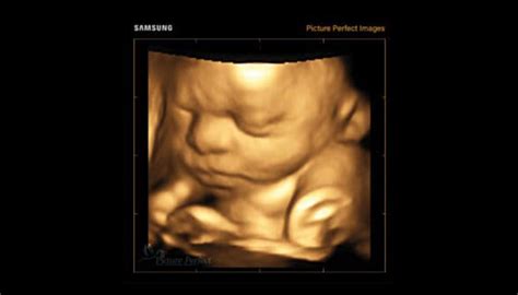 ecografie 3D a unui fetus la 14 săptămâni