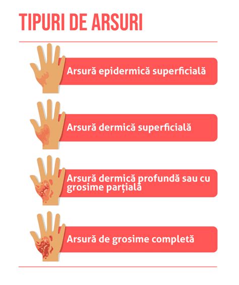 Infografic comparativ al gradelor de arsură cu imagini reprezentative