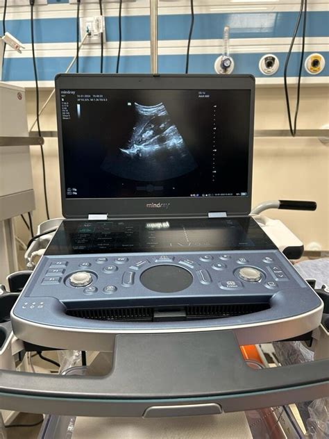 Imagine cu un aparat ecograf modern