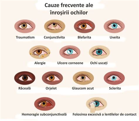 ochi roșii la copil cu secreții