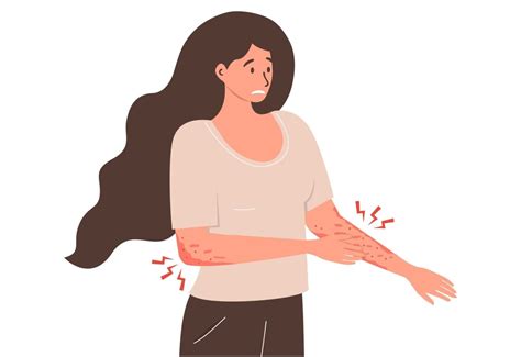 Ilustrație cu bebeluș și diverse tipuri de iritații sau vinisoare roșii pe față.