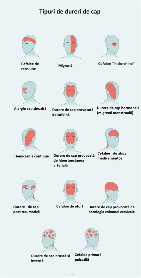 ilustrație cu semnale de alarmă pentru durerile de cap în sarcină