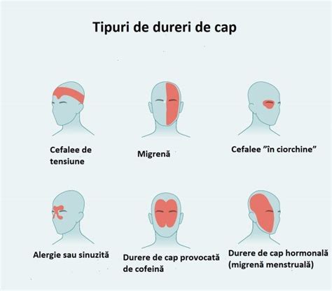 infografic cu sfaturi de prevenire a durerilor de cap în sarcină