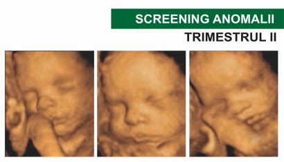 ecografie 4D a unui făt în trimestrul 2 de sarcină