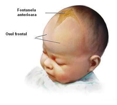 ilustrație comparativă: fontanela normală vs. fontanela adâncită la bebeluș, explicând legătura cu deshidratarea