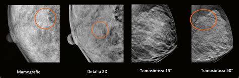Imagine cu o mamografie sau ecografie ginecologică.