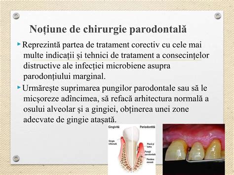 Ilustrație anatomică a gingiei și osului alveolar, evidențiind zona subgingivală.