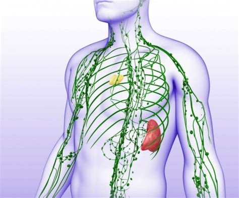 imagini cu ganglionii limfatici măriți și o schemă a procedurii de biopsie