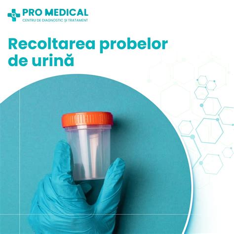 ilustrație cu tuburi de analiză pentru urină și un microscop