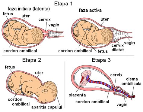 Ilustrație cu etapele travaliului: dilatarea colului, expulzia bebelușului, expulzia placentei