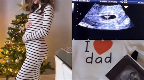 Ilustrație cu o graviduță la 29 de săptămâni, arătând abdomenul proeminent și eventualele umflături la picioare.