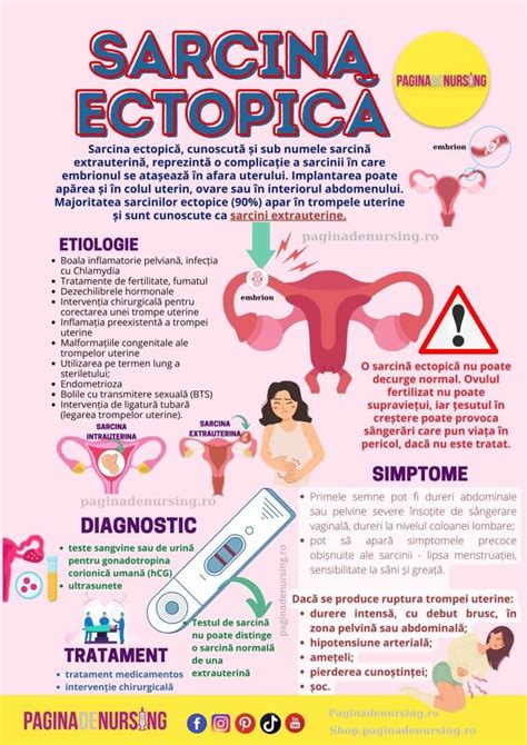 Infografic explicativ despre sarcina gemelară